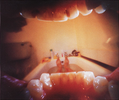 mouth-held pinhole camera image